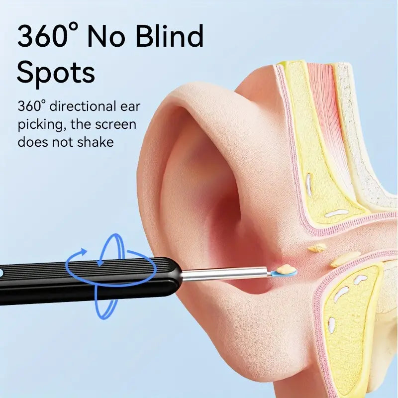 1080P HD Ear Wax Removal Tool with Camera-Rechargeable