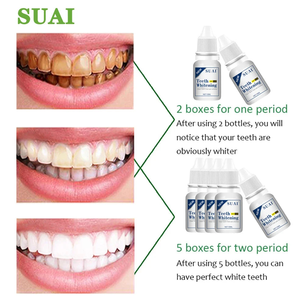 Teeth Whitening Kit- 50% Off